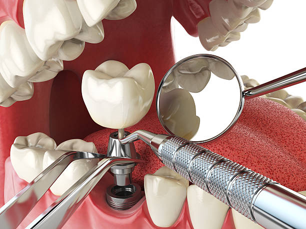 Best Weekend Emergency Dentist in South Holland, IL